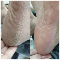 خدمات تخصصی پدیکور کیانشهر|خدمات زیبایی و سلامت|کرمانشاه, |دیوار