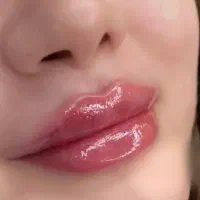 ژل و بوتاکس|خدمات آرایشگری و زیبایی|تهران, صادقیه|دیوار