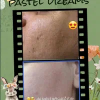 خاویارتراپی صورت و بدن|خدمات آرایشگری و زیبایی|مشهد, طلاب|دیوار