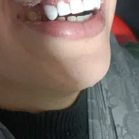 دندان سازی.دندان پزشکی