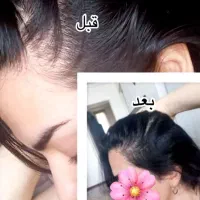 .پک گیاهی تقویتی و ضد ریزش و رویش مجدد مو|آرایشی، بهداشتی، درمانی|چالدران, |دیوار