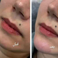 کلیه خدمات زیبایی در مطب زیبایی