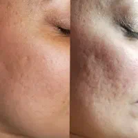 پوست و موی زیبا|آرایشی، بهداشتی، درمانی|ساری, |دیوار