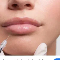 بوتاکس و جوانسازی و ژل توسط پزشک با تخفیف