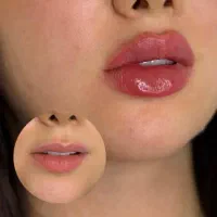ژل لب روسی زاویه فک گونه چونه فیلرزیرچشم شقیقه نخ|خدمات آرایشگری و زیبایی|تهران, پاسداران|دیوار
