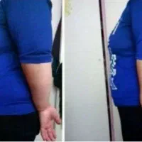 درمان در طبیعت