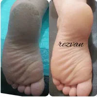 پدیکور وناخن