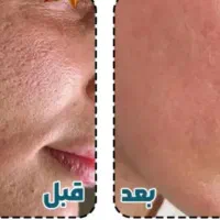 فشیال و تمامی خدمات پوستی|خدمات آرایشگری و زیبایی|خرم‌آباد, |دیوار