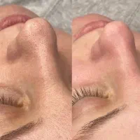 خدمات تخصصی پوست و زیبایی صورت ۵۰٪آف تا فردا|خدمات آرایشگری و زیبایی|مشهد, دانشجو|دیوار