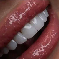 طرف قرارداد با بیمه ها/قیمت استثنایی/باکیفیت|خدمات آرایشگری و زیبایی|شیراز, ملاصدرا|دیوار