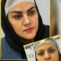جشنواره کاشت ابرو و مو تخصصی