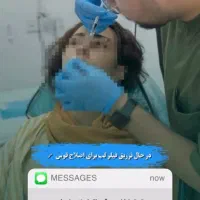 آخرین تخفیف ژل و فیلر، بوتاکس، مزوتراپی، پی آرپی|خدمات آرایشگری و زیبایی|آق قلا, |دیوار