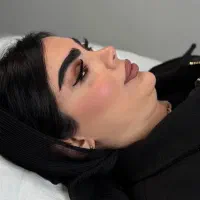 وی لاین تکنیک انحصاری کیلینیک مهرزاد ساکشن غبغب|خدمات آرایشگری و زیبایی|تهران, الهیه|دیوار