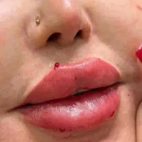 جشنواره ژل و بوتاکس و فیلر بادی و لیفت صورت|خدمات آرایشگری و زیبایی|تهران, صادقیه|دیوار