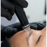 جوانسازی و پاکسازی تخصصی