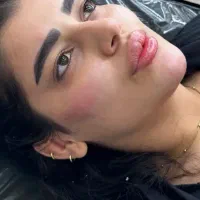 تخفیف تزریق ژل وبوتاکس|خدمات آرایشگری و زیبایی|آمل, |دیوار