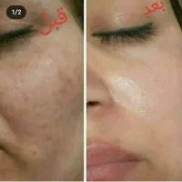 کرم لکه بر وروشن کننده بلور