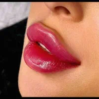 جشنواره بهارانه فیلر ژل بوتاکس جوانساز PRP