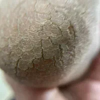 تخفیف ویژه یلدایی خدمات کاشت ناخن و اسپا|خدمات آرایشگری و زیبایی|بندر گناوه, |دیوار