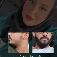 ر.یش مو.سبیل ر.یزش سکه.ای