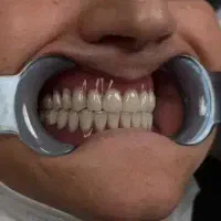 خدمات دندانسازی و زیبایی