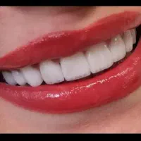 خدمات دندانپزشکی