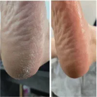 پدیکور|خدمات آرایشگری و زیبایی|زنجان, |دیوار