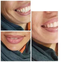 زیبایی پوست ومو|خدمات آرایشگری و زیبایی|ایذه, |دیوار