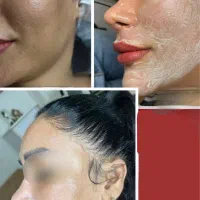 برای اولین باردر کرمان گلاتاتیون تضمین پوست کره ای