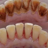 خدمات درمانی و زیبایی دندان|خدمات آرایشگری و زیبایی|کرمانشاه, |دیوار