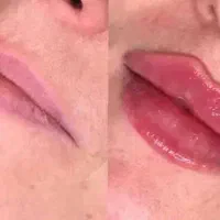 خدمات ژل بوتاکس مزو و آنزیم کاشت ناخن مژه اکستنشن.