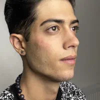 تزریقات زیبایی بوتاکس، فیلر، چربی، مزو، نخ لیفت