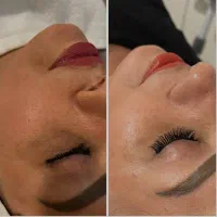 پاکسازی و فیشیال تخصصی