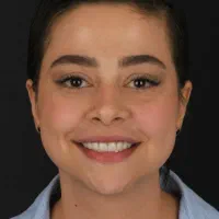 شرایط استثنایی ویژه ایمپلنت،اوردنچر،دندان مصنوعی|خدمات آرایشگری و زیبایی|تهران, مجیدیه|دیوار