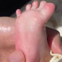 خدمات پرستاری درمنزل وصل ، سرم ،پانسمان وتزریقات|خدمات آرایشگری و زیبایی|زاهدان, |دیوار