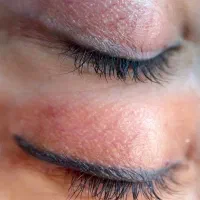 ریموو تخصصی درتربت جام