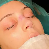 خدمات عمل جراحی زیبایی بینی و ترمیم بینی|خدمات آرایشگری و زیبایی|تهران, فلاح|دیوار