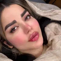 ژل گونه چونه زاویه خط خنده بوتاکس مزو آنزیم پرسینگ