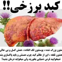 اصلاح مزاج، درمان مشکلات کبدی
