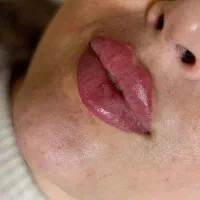 مطب پوست مو و لیزر محمدشهر|خدمات آرایشگری و زیبایی|محمدشهر, محمدشهر|دیوار