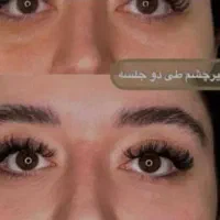 تزریق ژل و بوتاکس تضمینی|خدمات آرایشگری و زیبایی|اهواز, نادری|دیوار