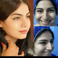 عمل زیبایی در بیمارستان بینی کاشت مو.بلفارو.بوتاکس