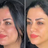 زیبایی|خدمات زیبایی و سلامت|کرج, ساماندهی|دیوار
