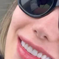 اجازه-اتاق-در-مطب-برا-کامپوزیت