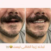 دندانسازی نیکو|خدمات آرایشگری و زیبایی|الوند, |دیوار