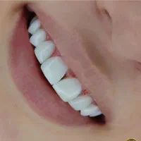 آفر خدمات تخصصی دندانپزشکی(اقساط و تخفیفات)
