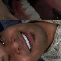 کامپوزیت‌زیبایی‌وایمپلنت‌وعصب‌کشی‌‌دندان|خدمات آرایشگری و زیبایی|تهران, شهید رجایی|دیوار
