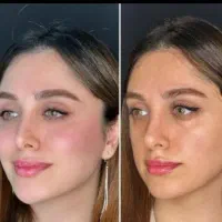 پی آر پی حجامت مزوژل بادکش امبدینگ طب سوزنی hpv|خدمات آرایشگری و زیبایی|اصفهان, جاوان|دیوار