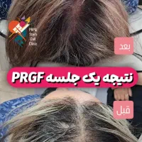 مرکز پی آر پی ،مزوتراپی ،سلول درمانی ،زانو،بوتاکس|خدمات آرایشگری و زیبایی|کرج, عظیمیه|دیوار