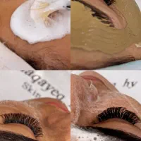 اموزش تخصصی خدمات  فیشیال پاکسازی پوست مزونیدلینگ